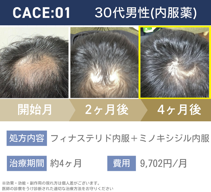 30代男性内服薬